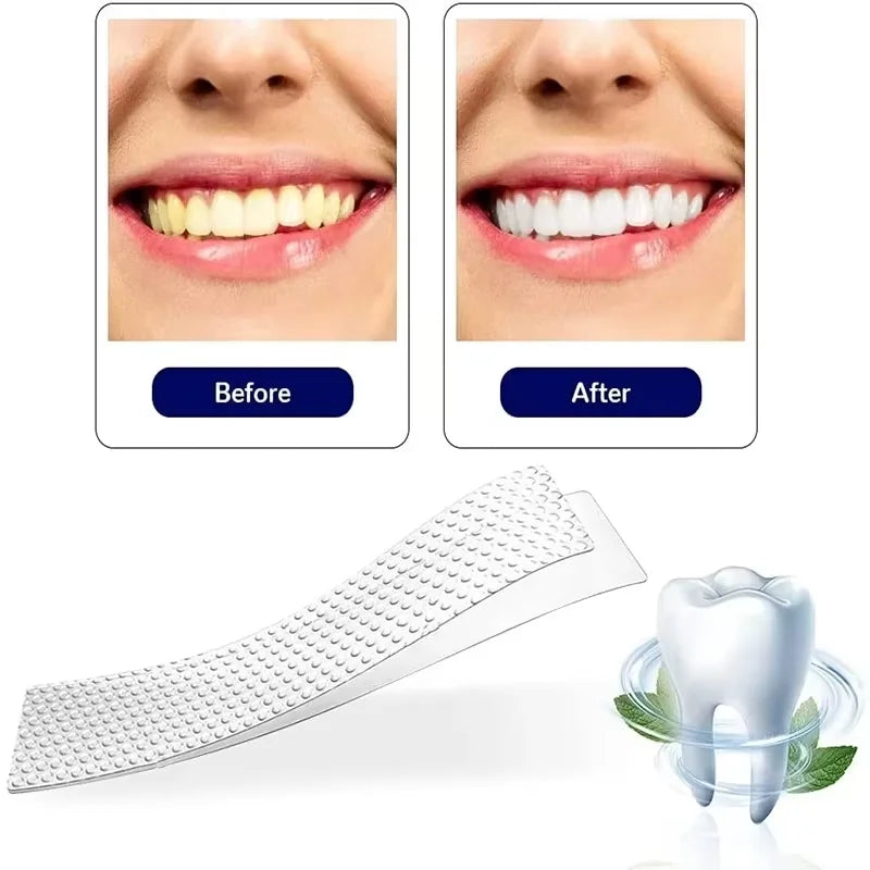 5D Whitening Teeth Strips